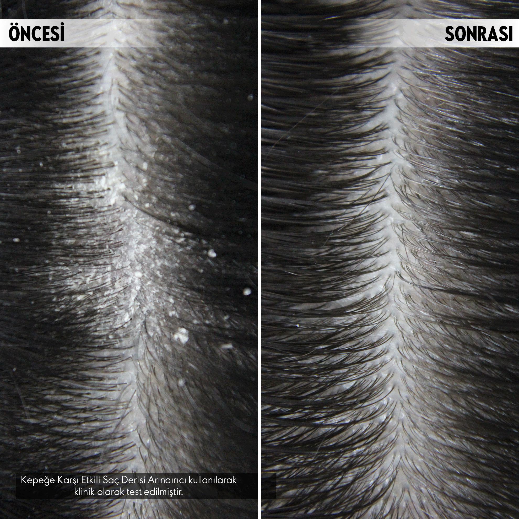 اسکراب ضد پوسته سر دئولوژی - Image 5